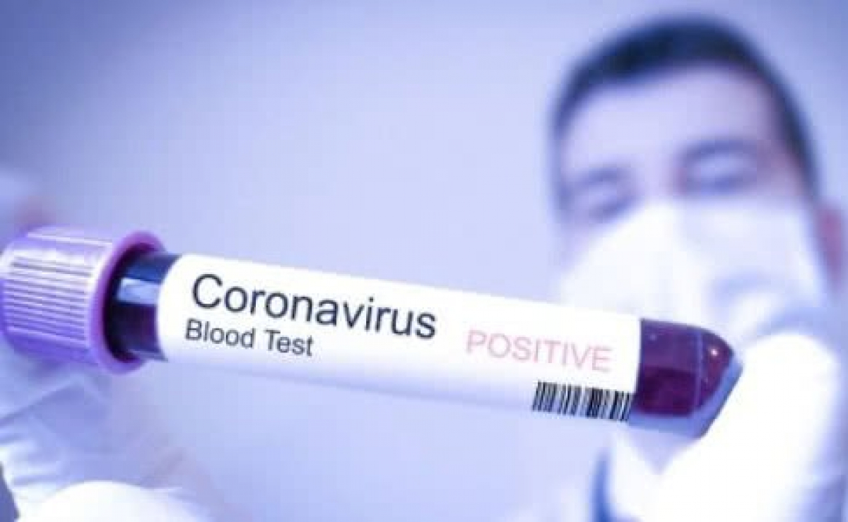У Херсоні за добу зафіксовано 1 новий випадок коронавірусу та 2 нових одужання У Херсоні за добу зафіксовано 1 новий випадок коронавірусу та 2 нових одужання