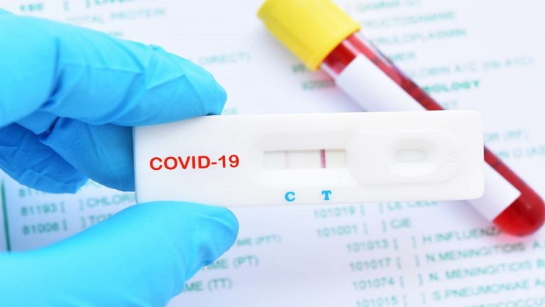 У Херсонській області за добу COVID-19 виявили у 75 людей, 1 людина померла від ускладнень