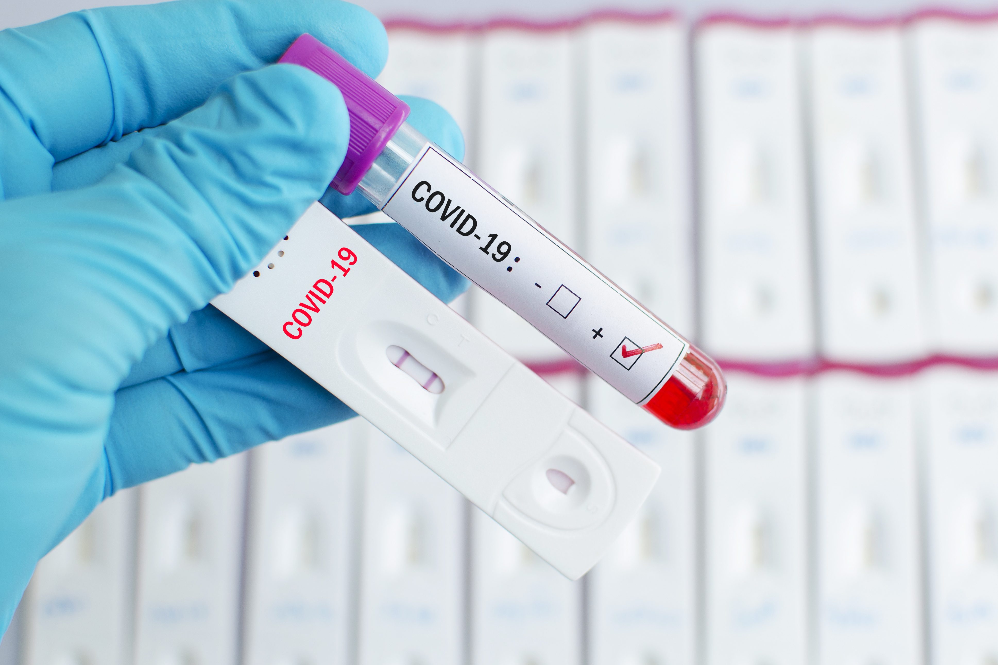 В Херсонской области – 224 новых случая COVID-19, 559 человек выздоровели